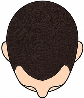 Stage 2