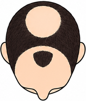 Stage 5